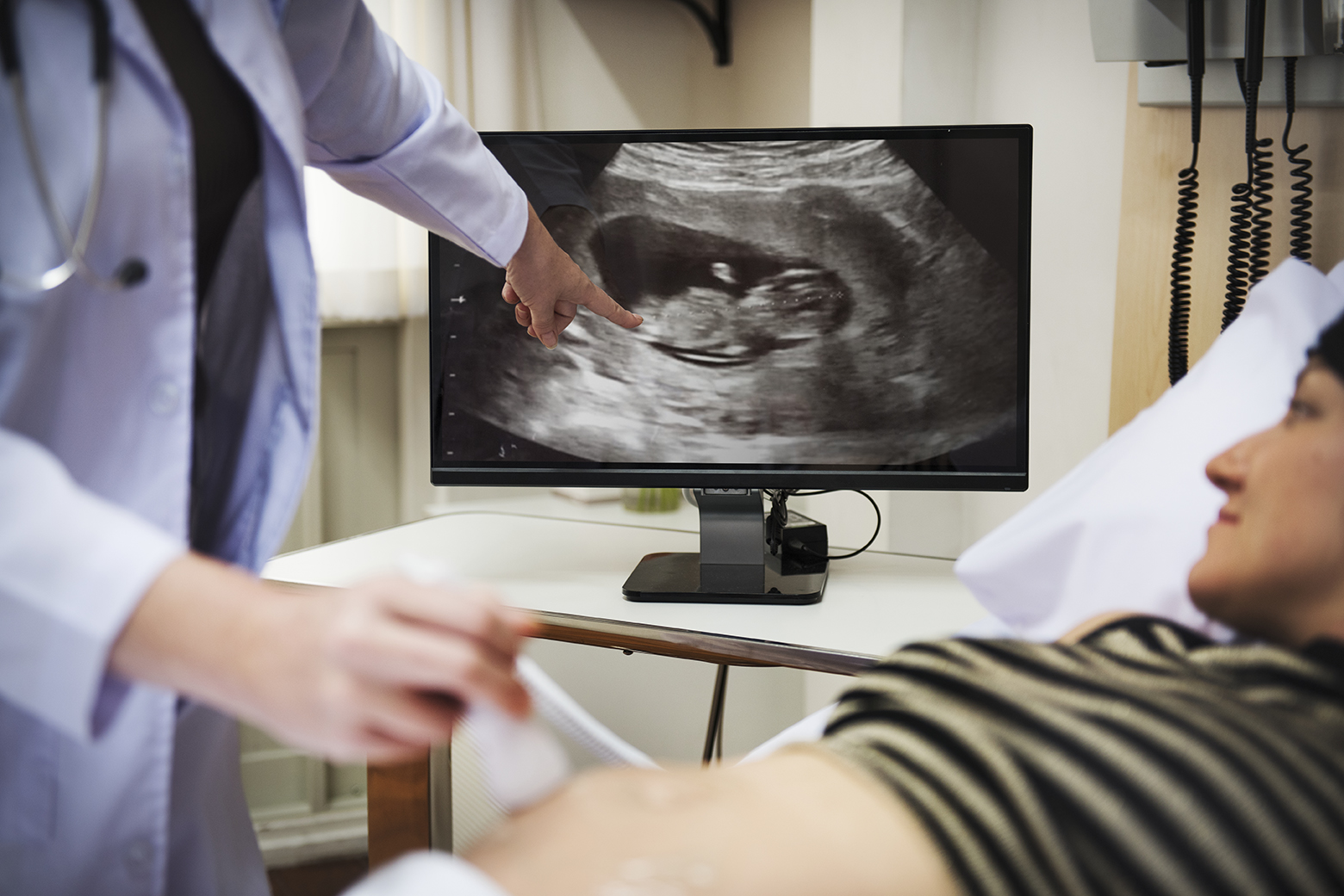 Doctor shows mother her baby on screen while performing ultrasound